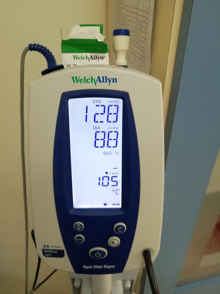 Welch Allyn Spot Vital Signs Monitor