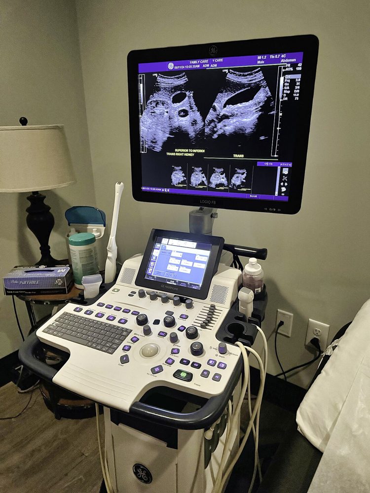 Cart-Based Colour Doppler Ultrasound System